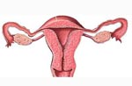 Гипоплазия матки. Лечение